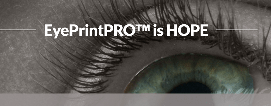 EyePrint