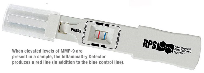 Test for Inflammation